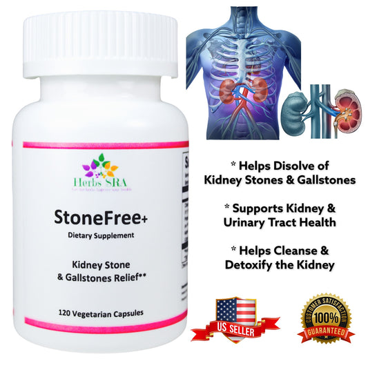 STONE FREE